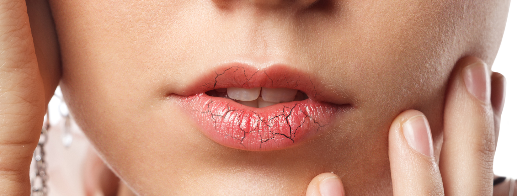porque siempre se me resecan los labios